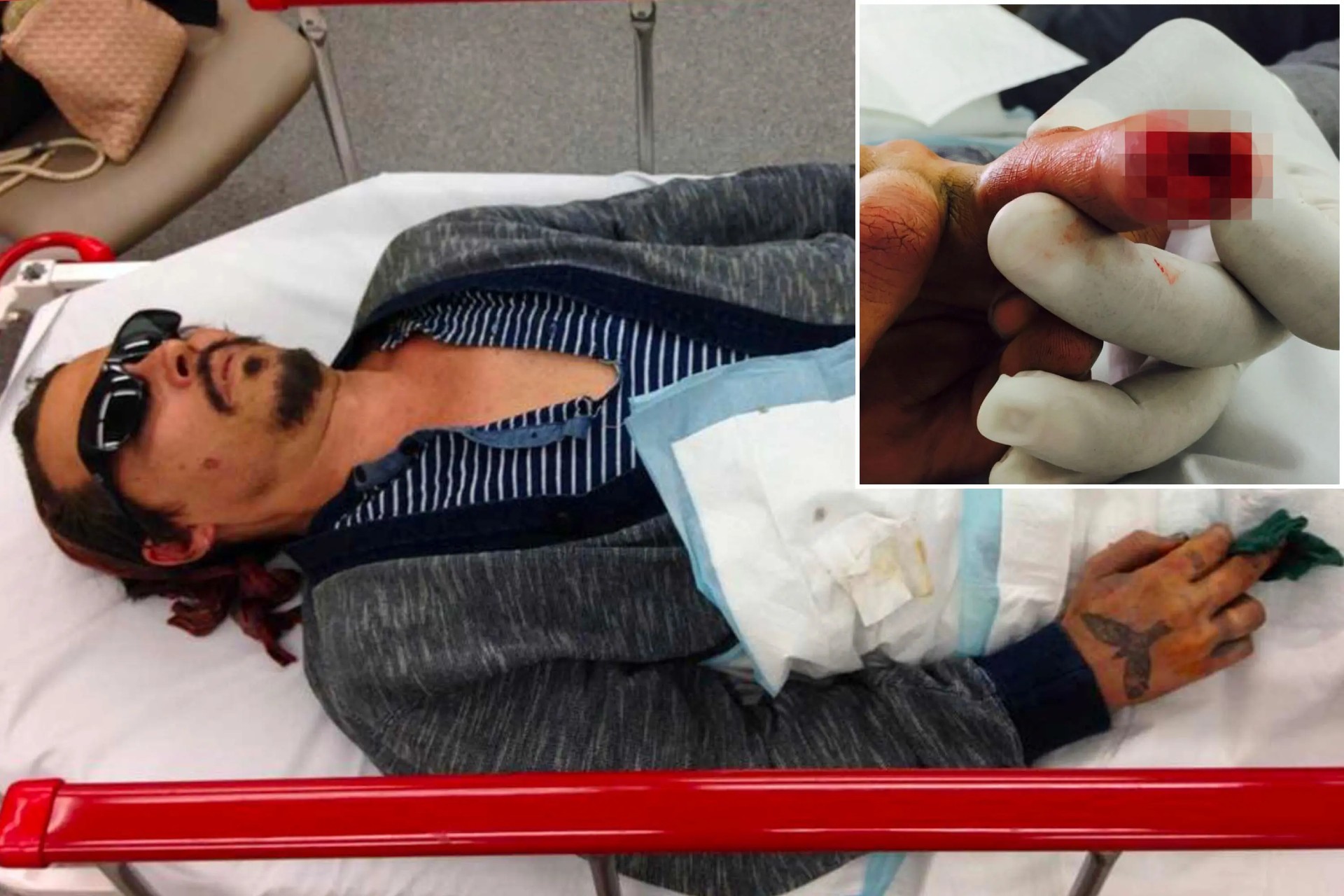 Depp Severed Finger