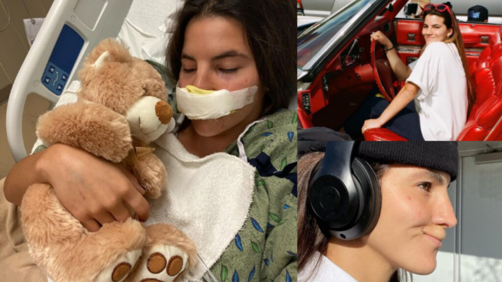Pro skater and model Brooke Khoury - Latest update after pitbull attack - Cover