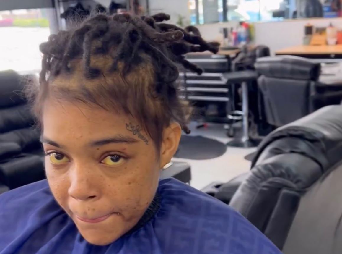 Young M.A yellow eyes viral video health