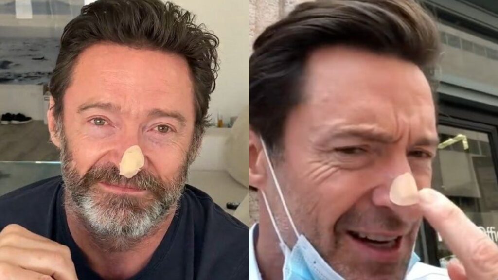 Hugh Jackman Skin Cancer scare Latest Update