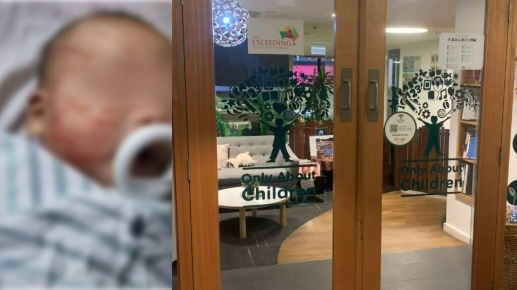 Melbourne baby picked up from childcare covered in scratches | Possible charges