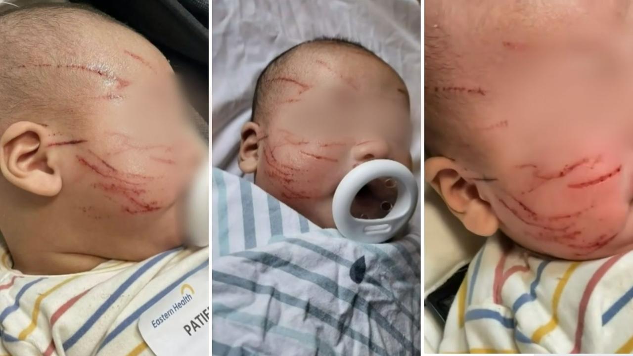 Melbourne baby childcare center scratches