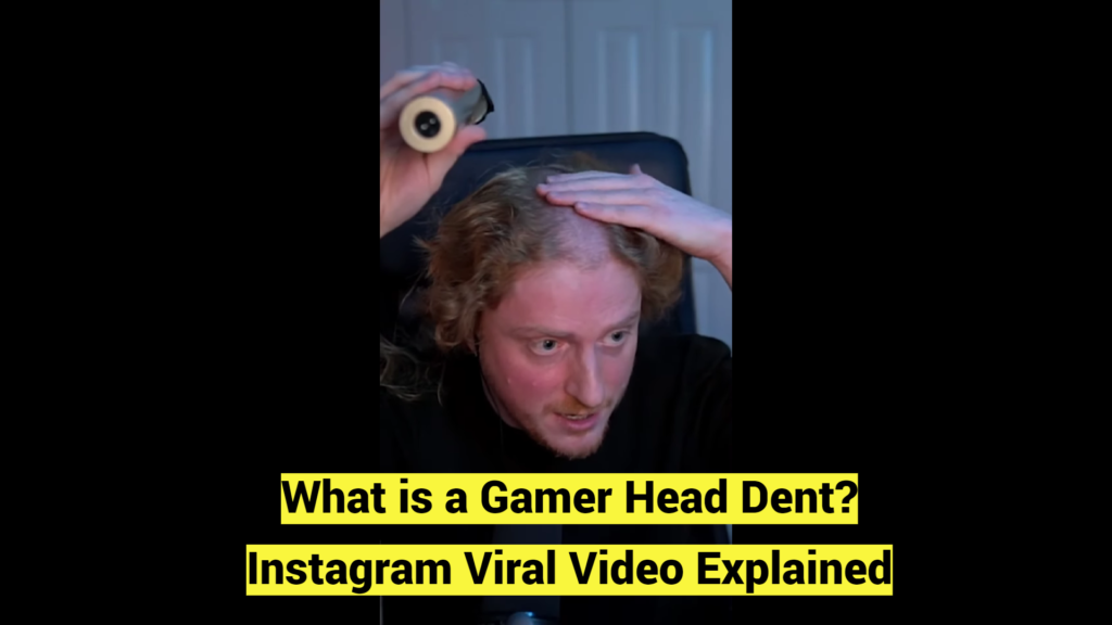 What is a Gamer Head Dent Instagram Viral Video Explained