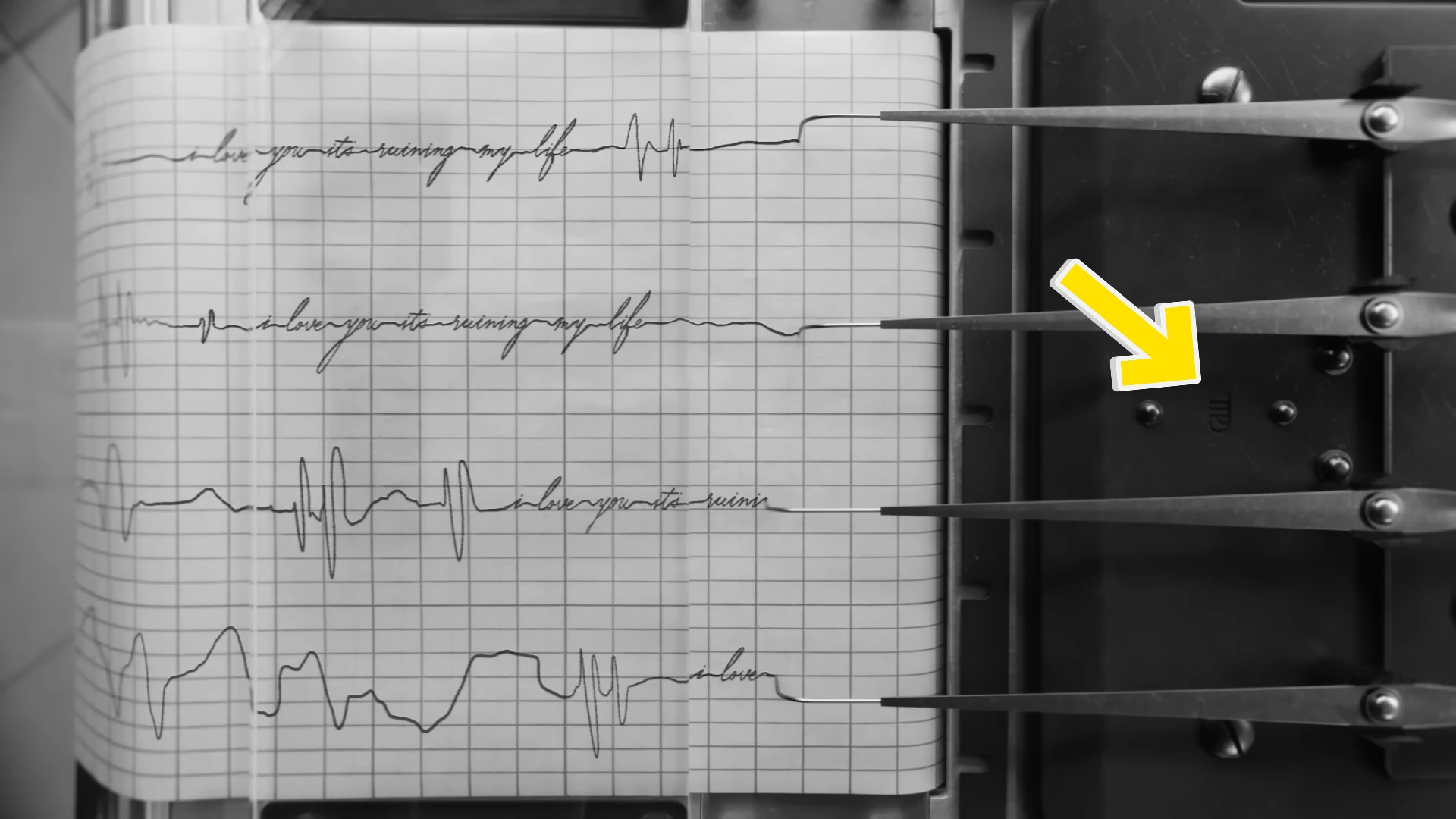 Taylor Swift Fornight EEG