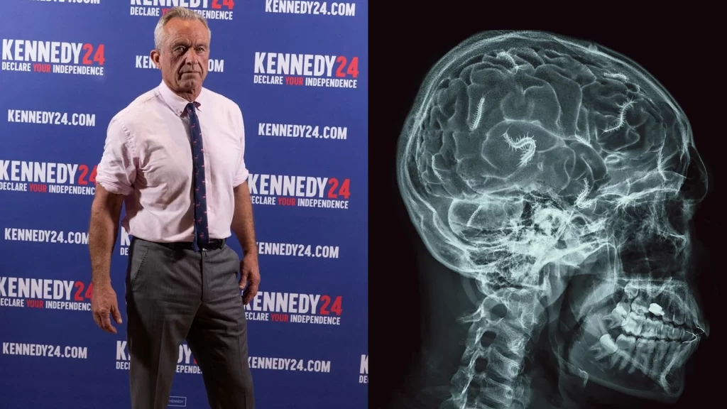 How Robert F. Kennedy Jr. Found a Dead Worm in His Brain