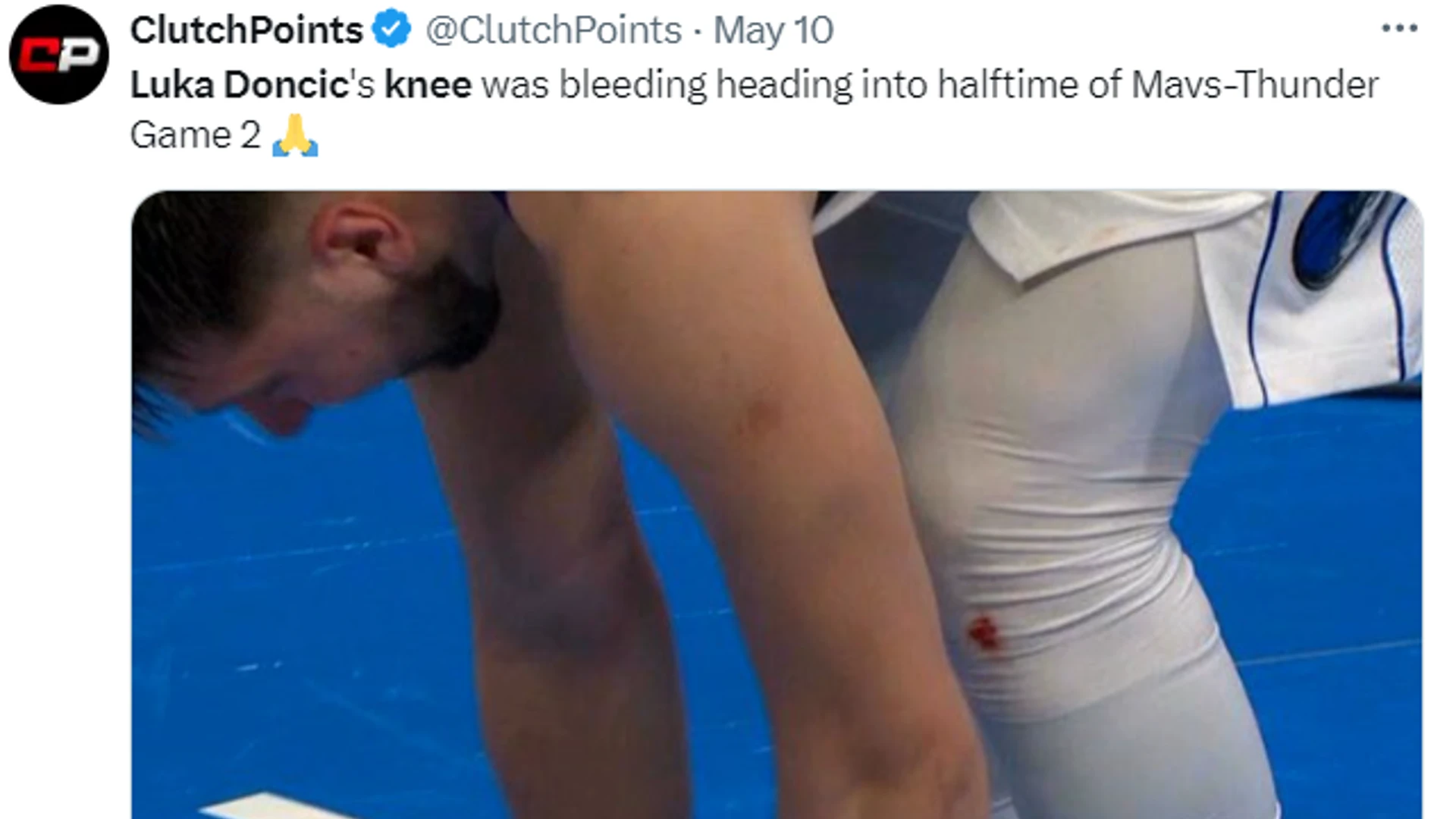 luka doncic's bleeding knees